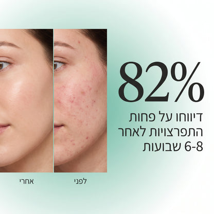 AcneClear - פתרון מתקדם לפצעי וצלקות אקנה
